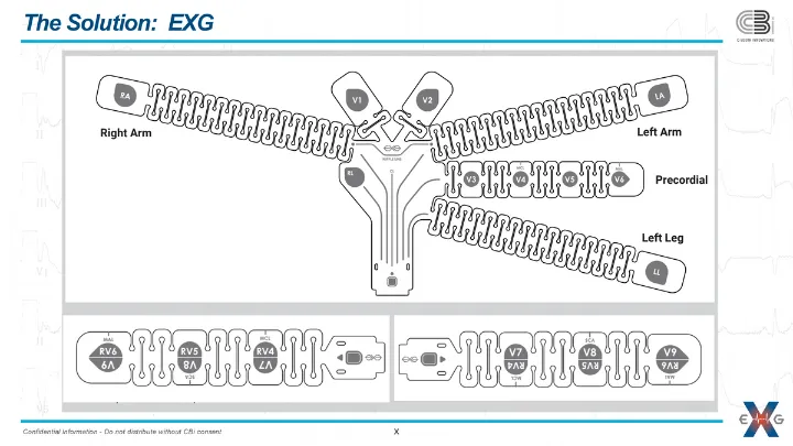 Location, Location, Location: Why Electrode Placement Matters