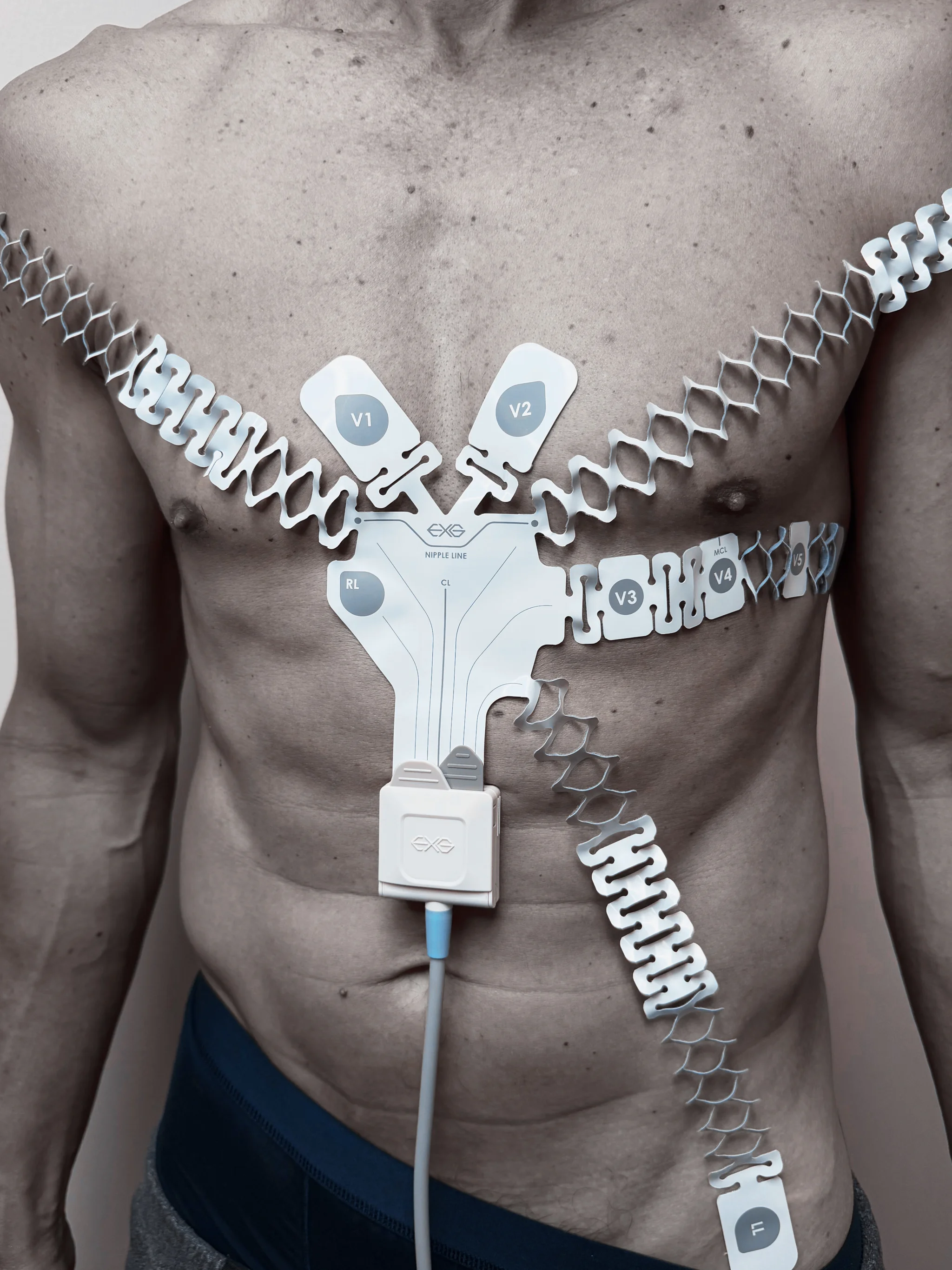 EXG 12-Lead Configuration