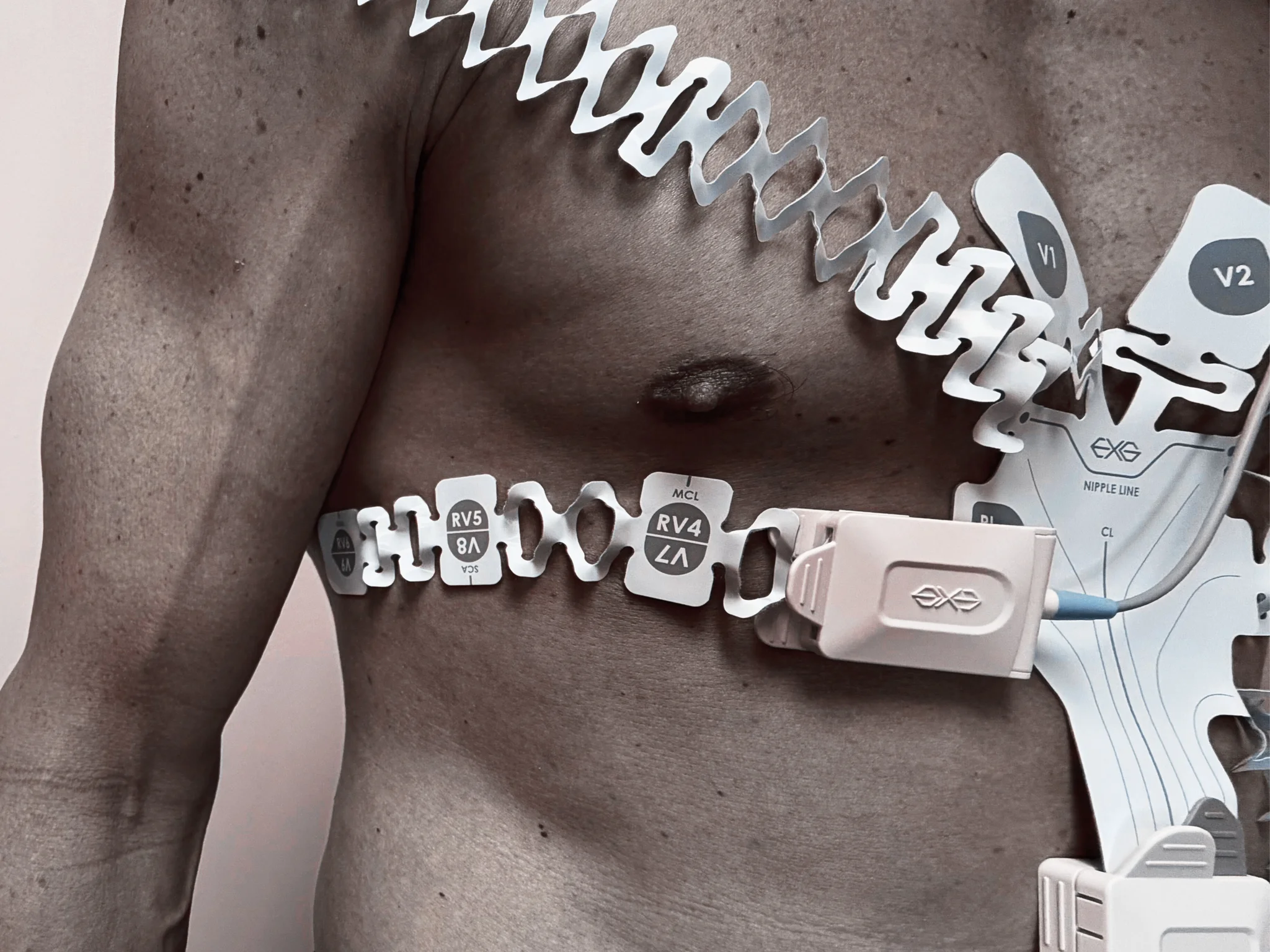 EXG Right-Sided 3-Lead Configuration