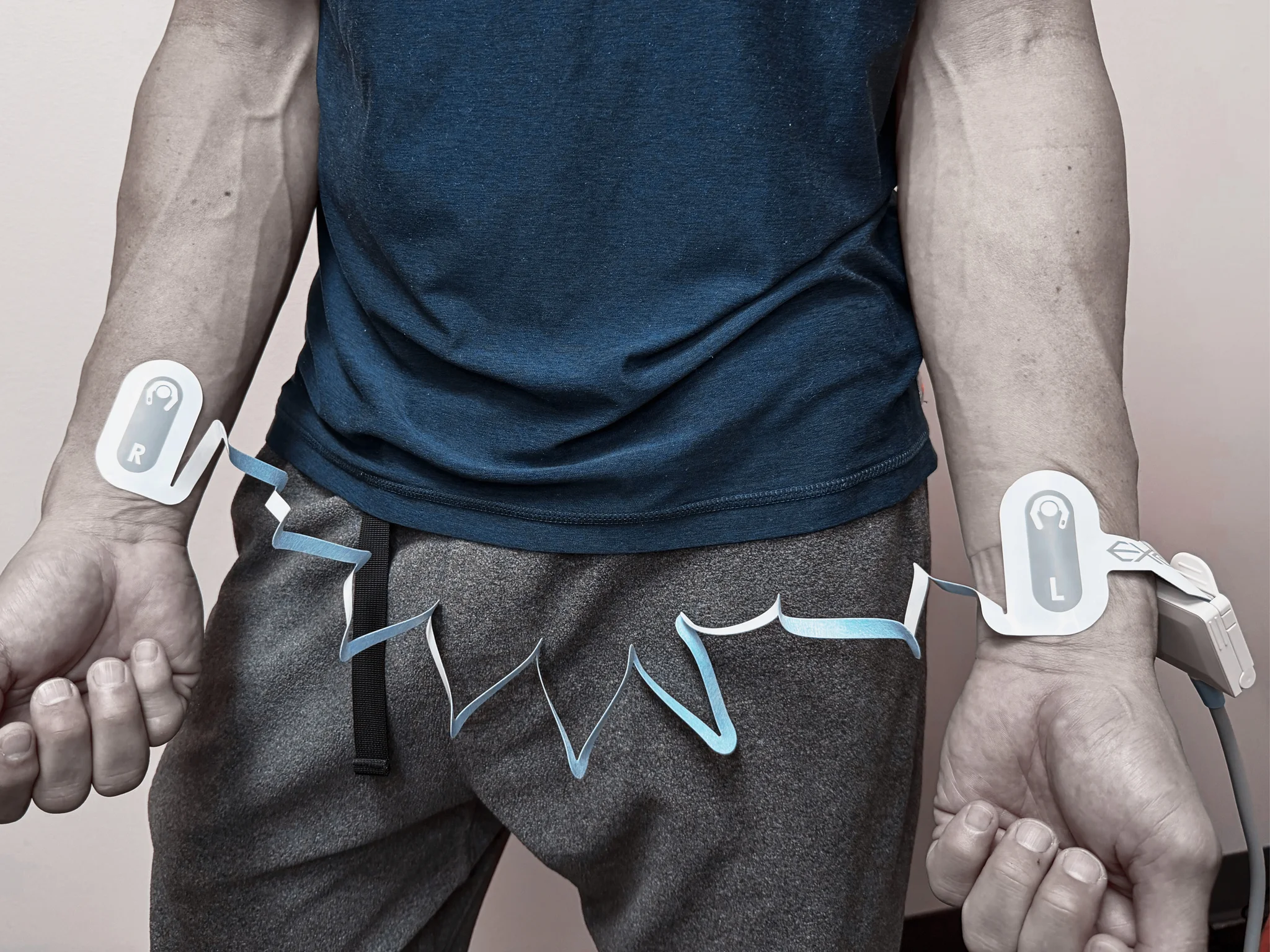 EXG 4-Lead Configuration