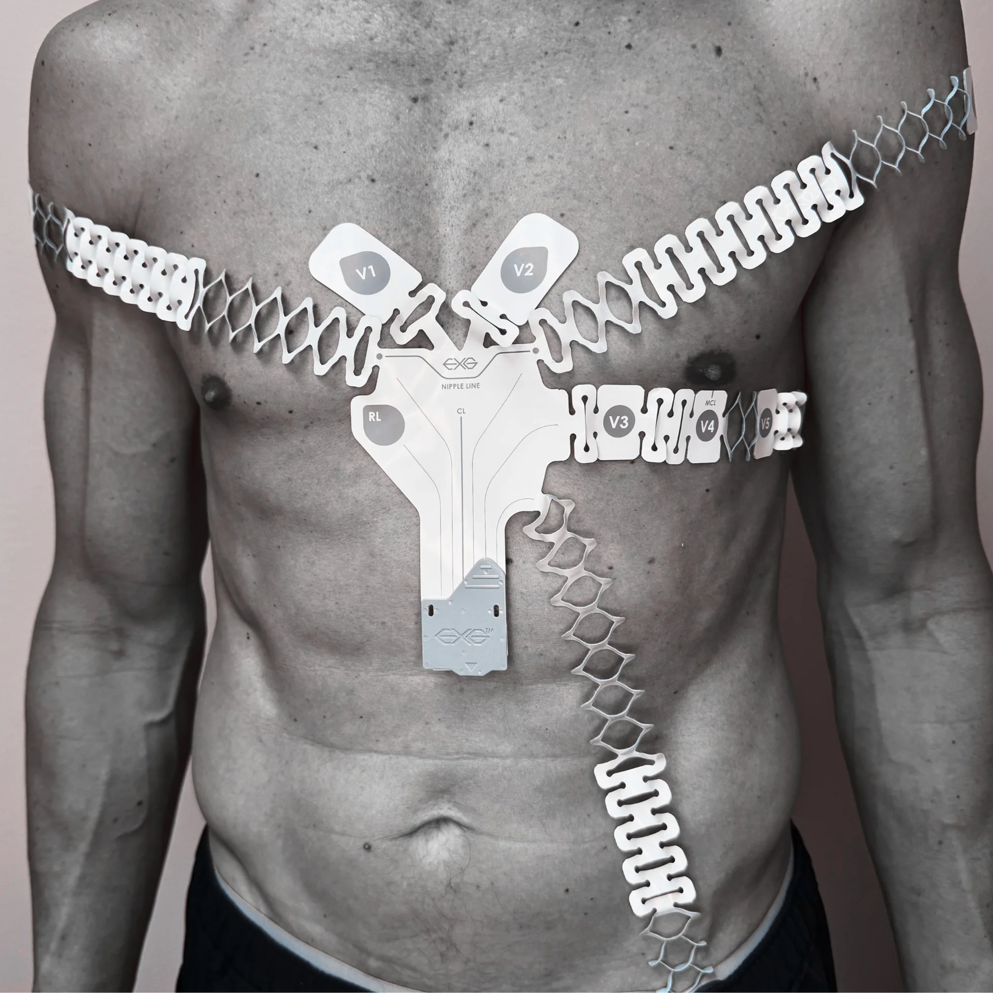 12-Lead ECG Placement: The Complete Guide for Clinicians & EMS Providers